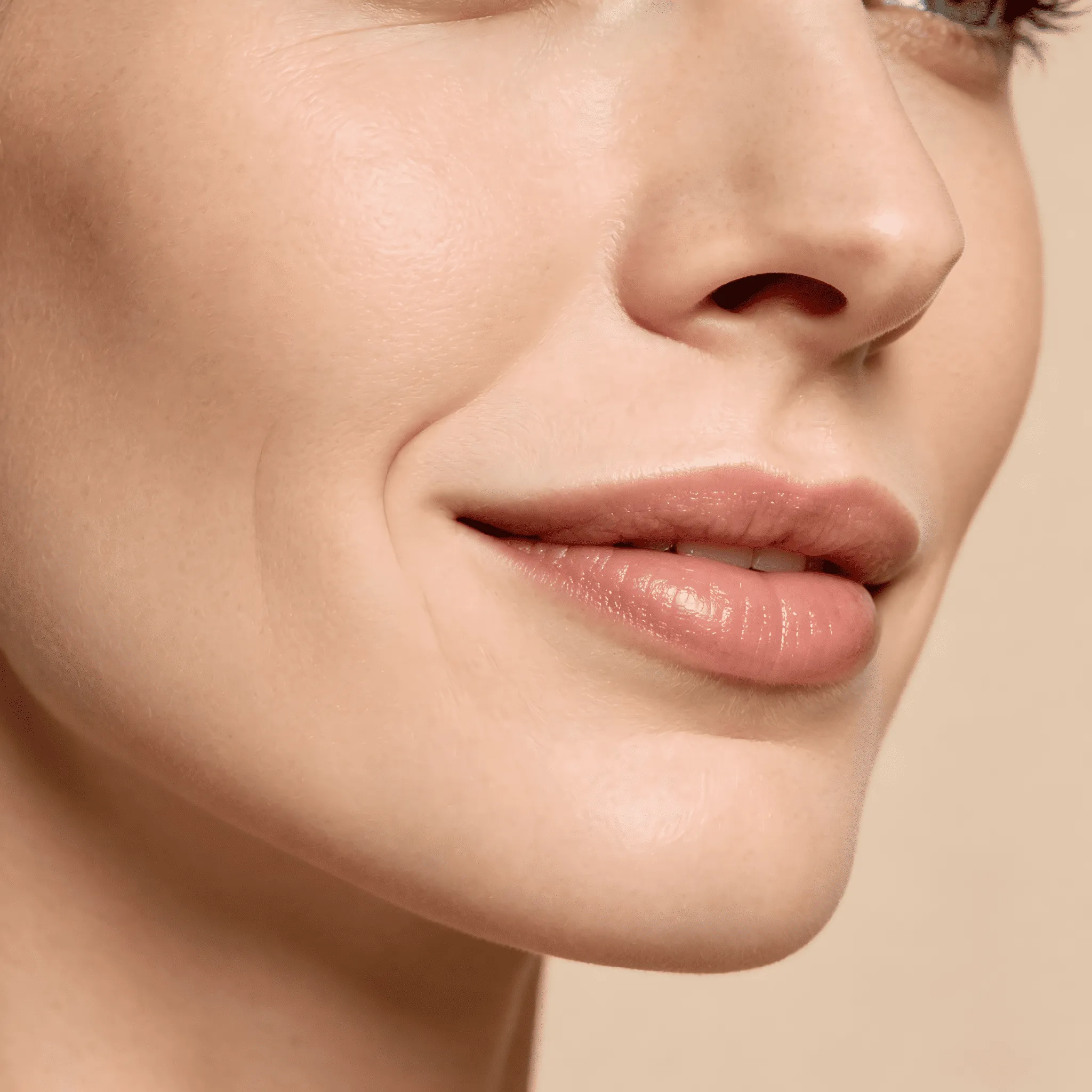 Nasolabial Folds