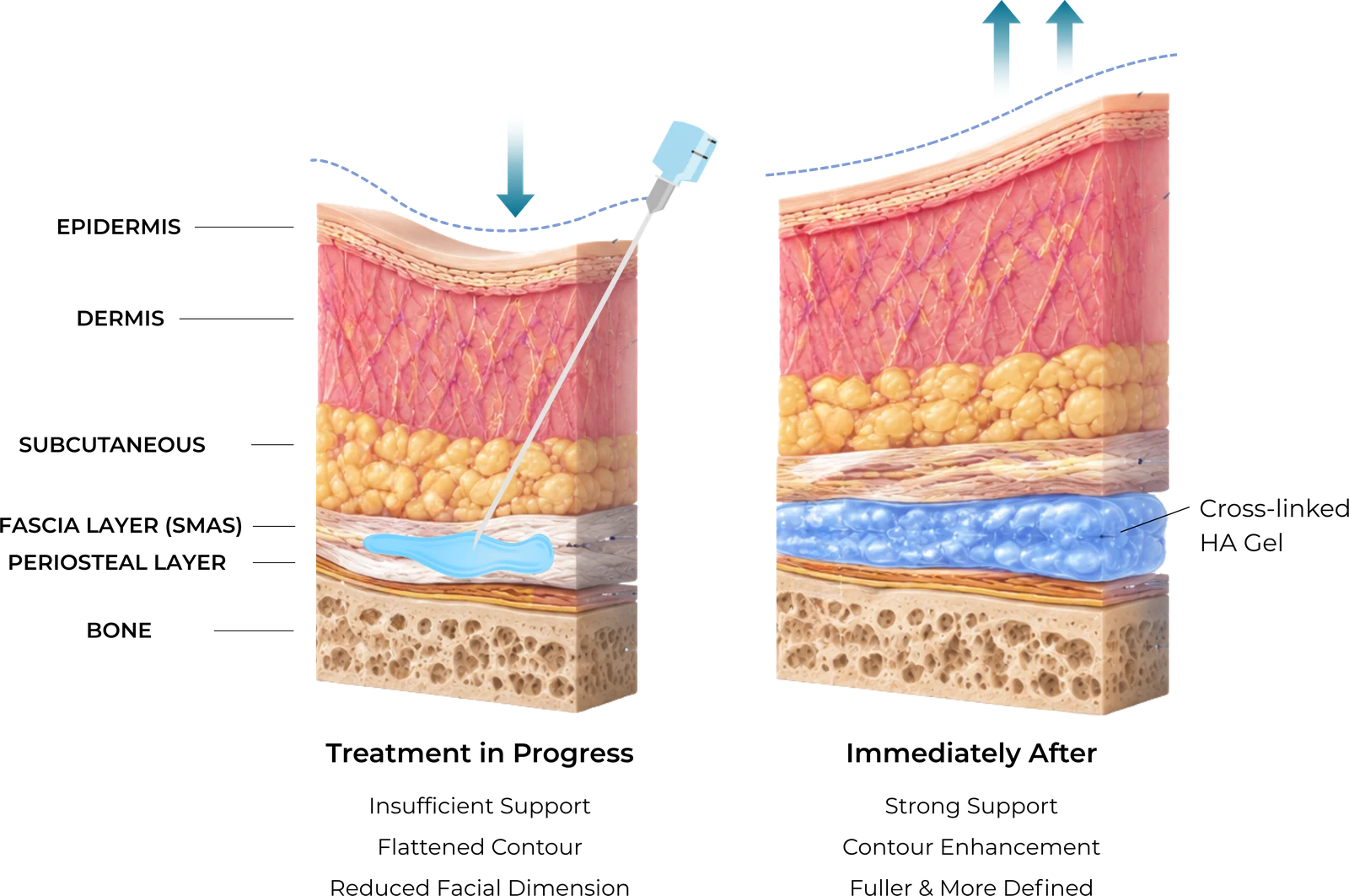 Diagram — mechanism of action