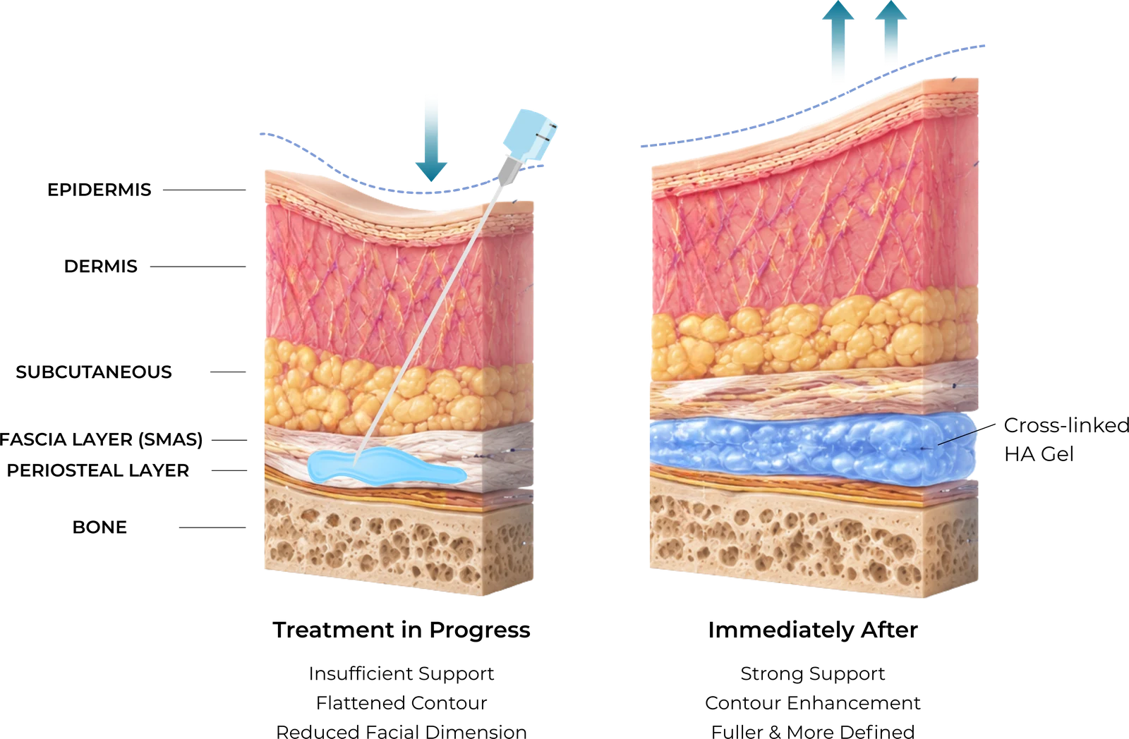 Diagram — mechanism of action