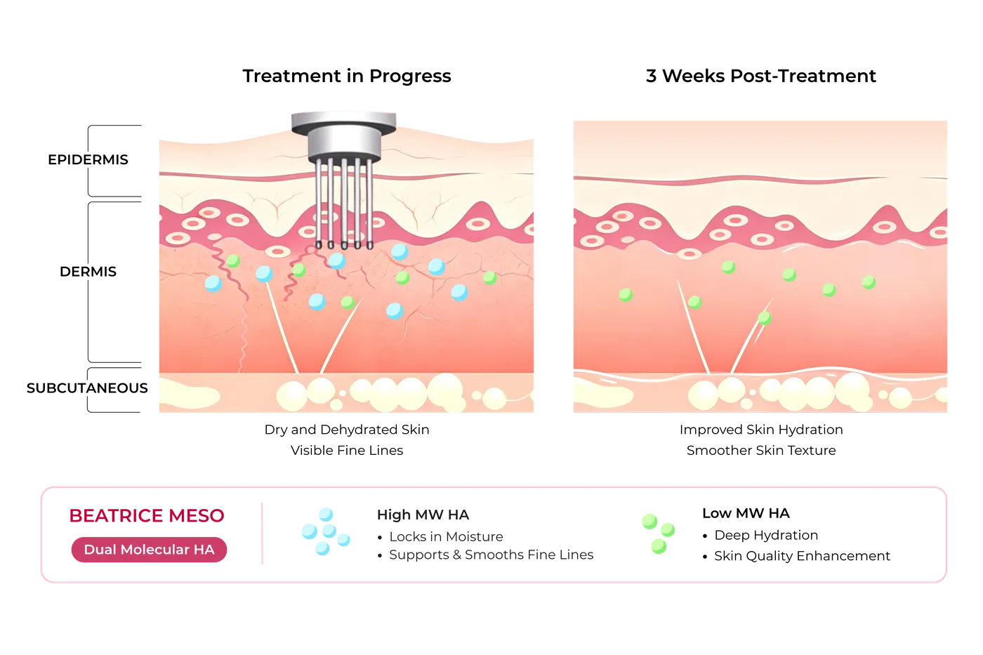 Diagram — mechanism of action