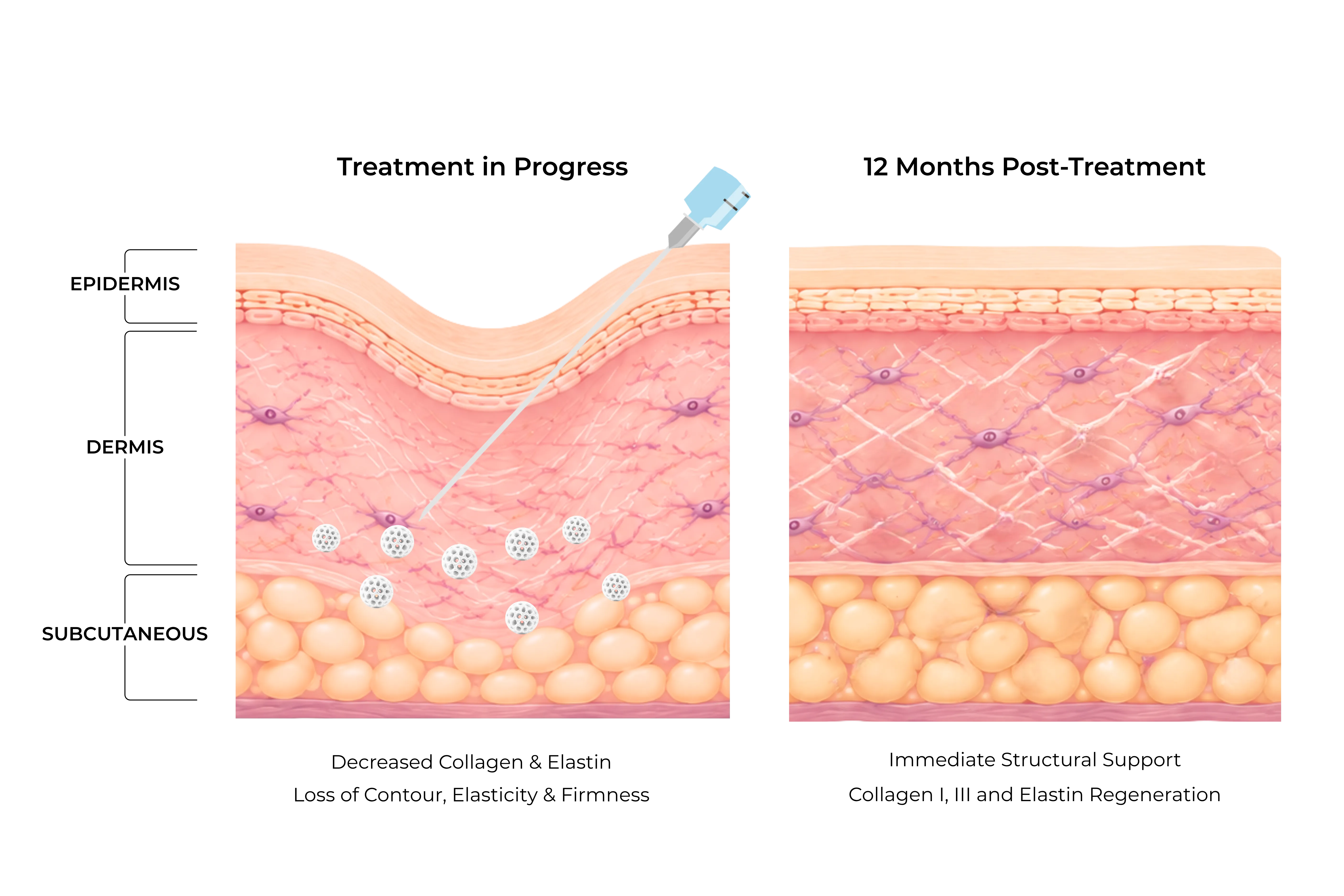 Diagram — mechanism of action