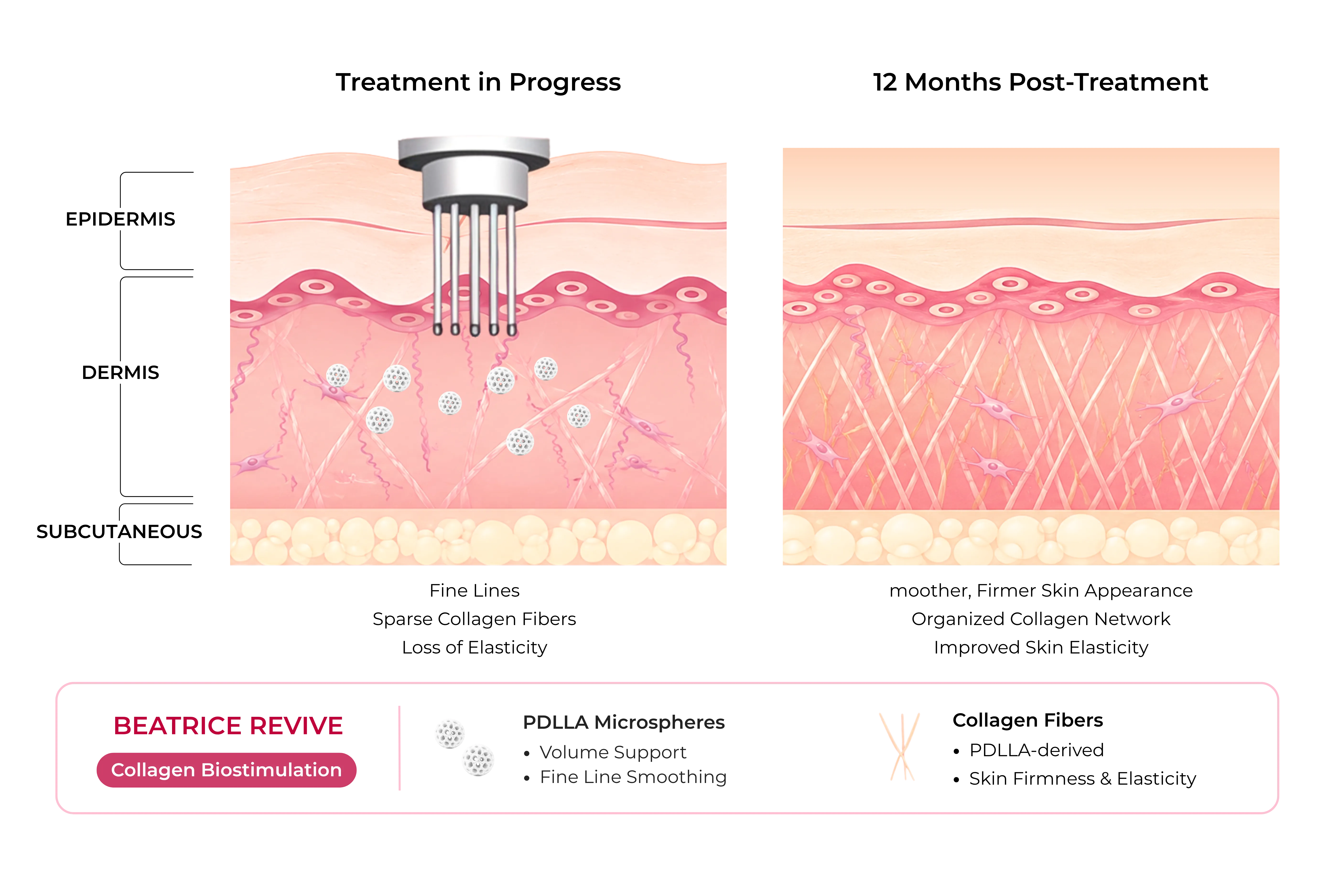 Diagram — mechanism of action