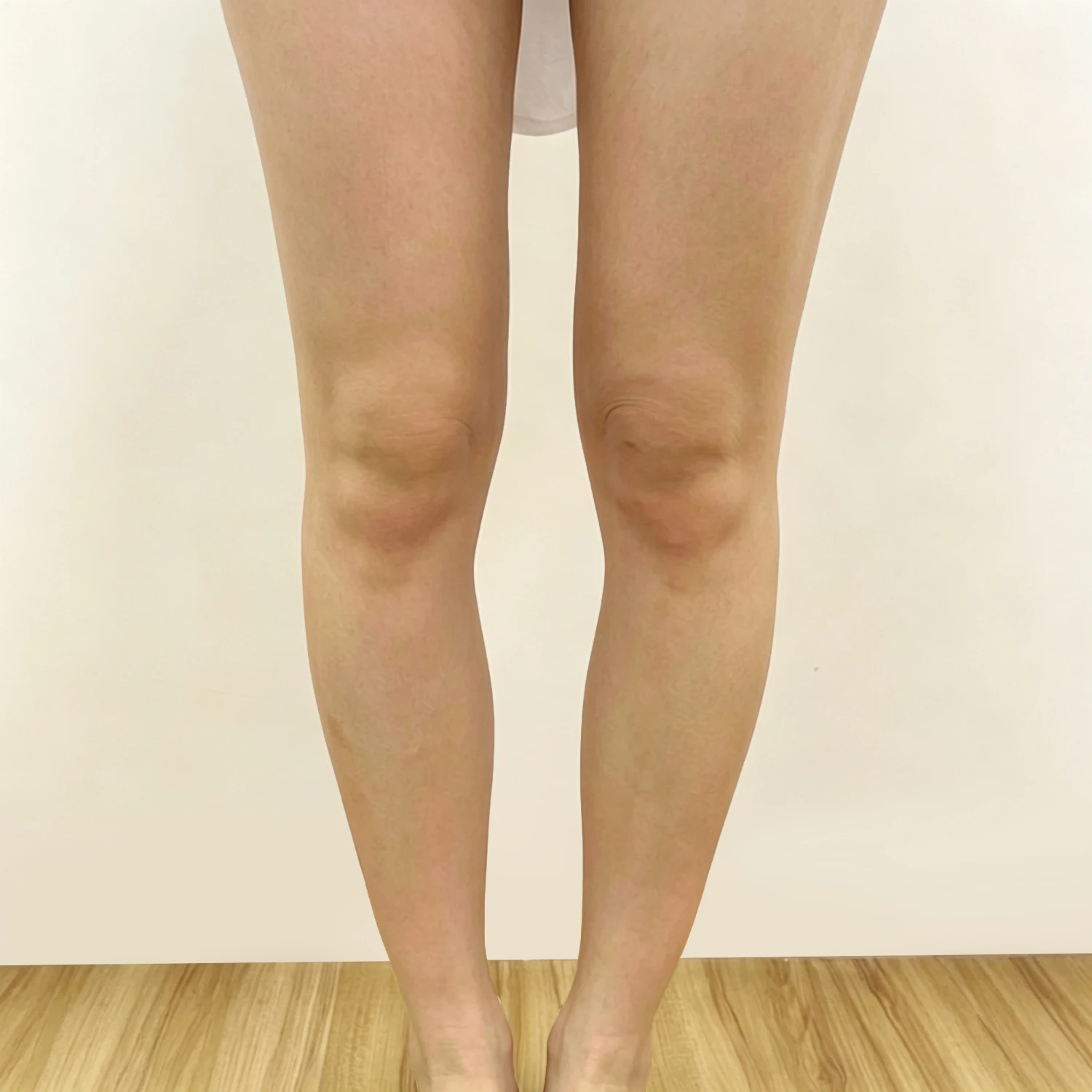 Before — Legs — Body