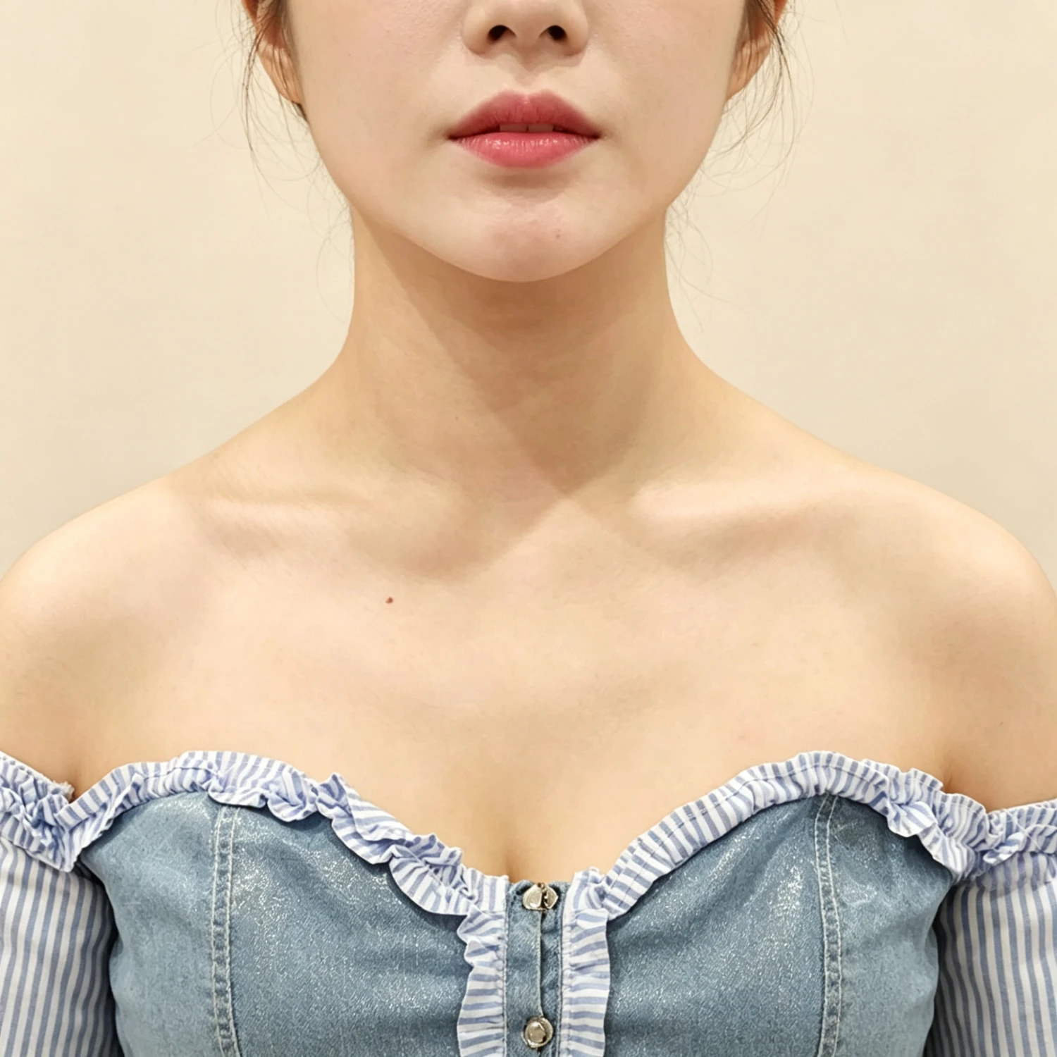Before — Straight Shoulder — Body