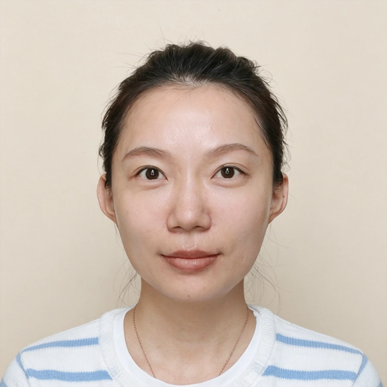 After — Cheek treatment case