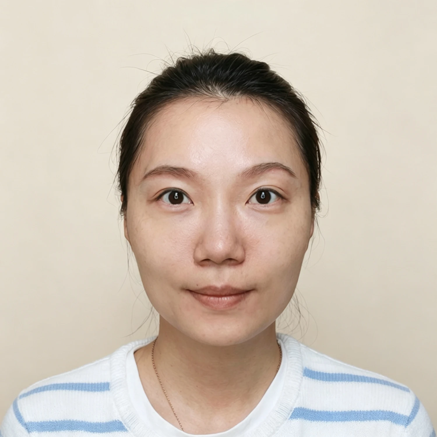 Before — Cheek treatment case