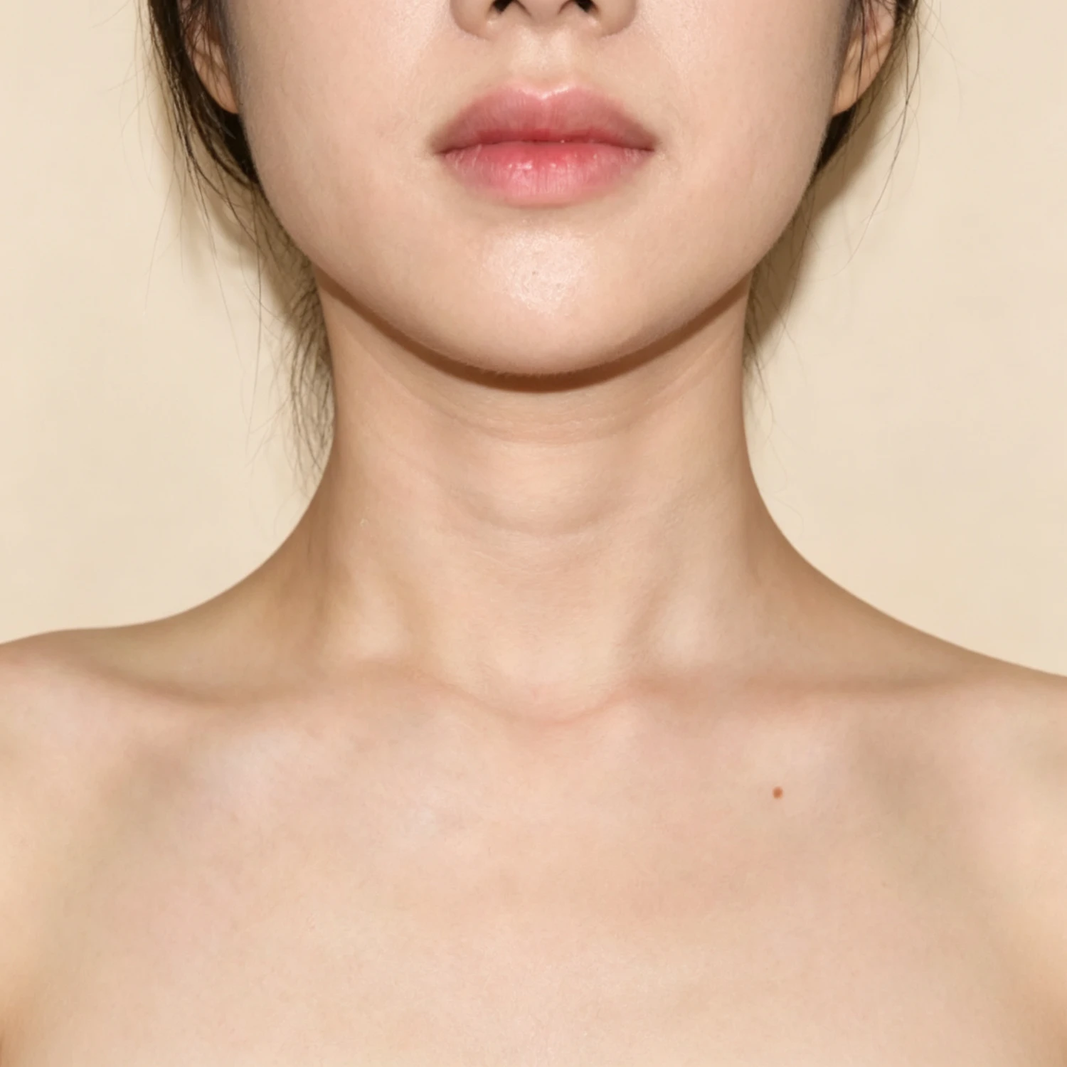 Before — Case A — Neck